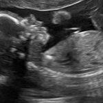 75573800_3214885278581416_2435596384997474304_n