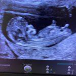 Afbeelding van Cynthia