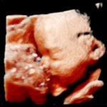 baby-Hobbel Pretecho Hellevoetsluis